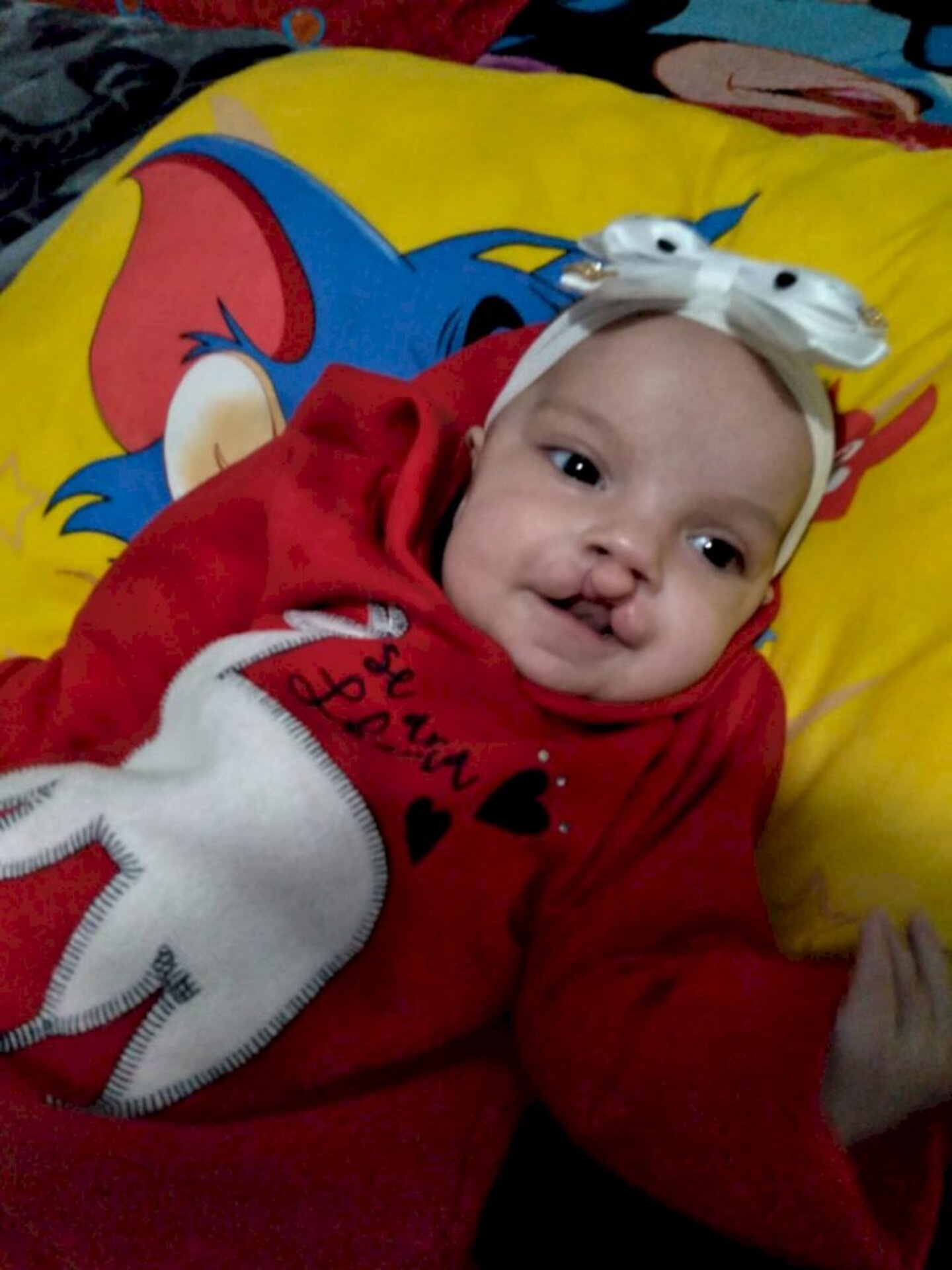 Pequena precisa passar por uma cirurgia em Porto Alegre
