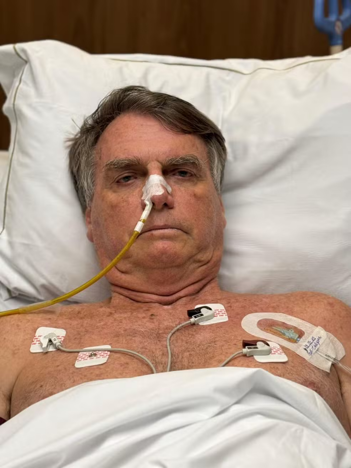 OAB Barro Preto - STF intima Bolsonaro no hospital