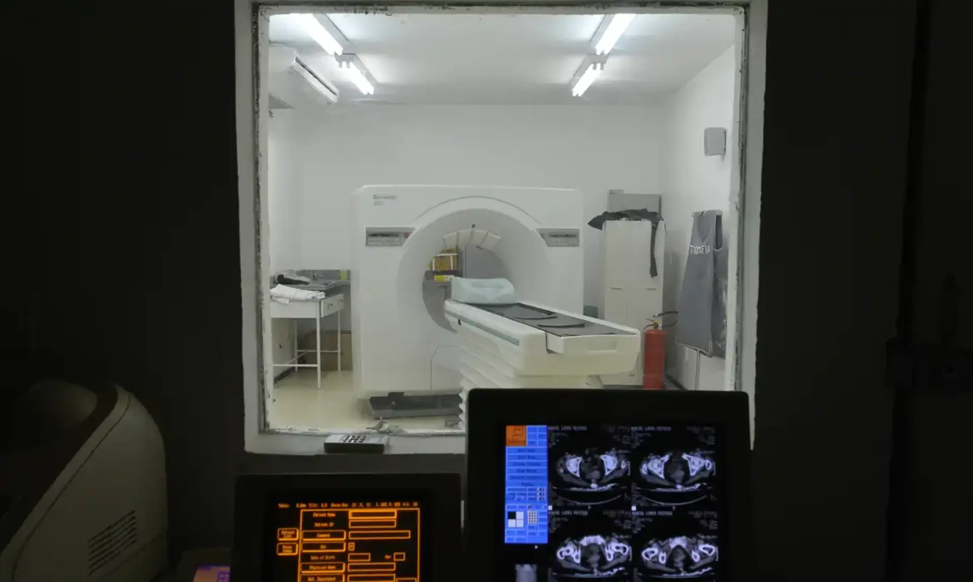 OAB Barro Preto - Bagé zera fila de tomografia