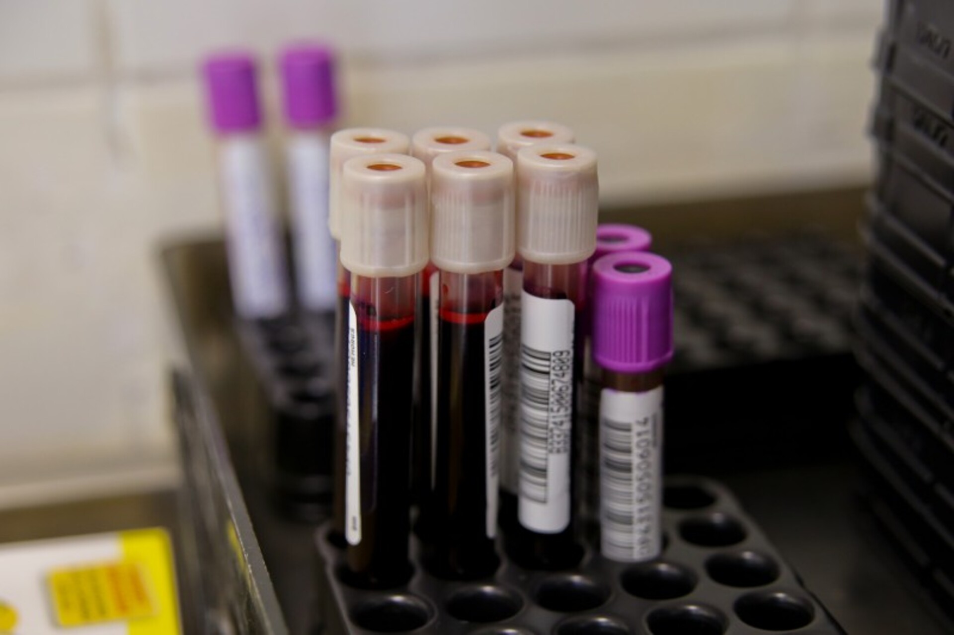 OAB Barro Preto - Com estoques baixos, apelo é para que população doe sangue